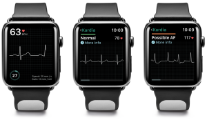 apple watch and AFib